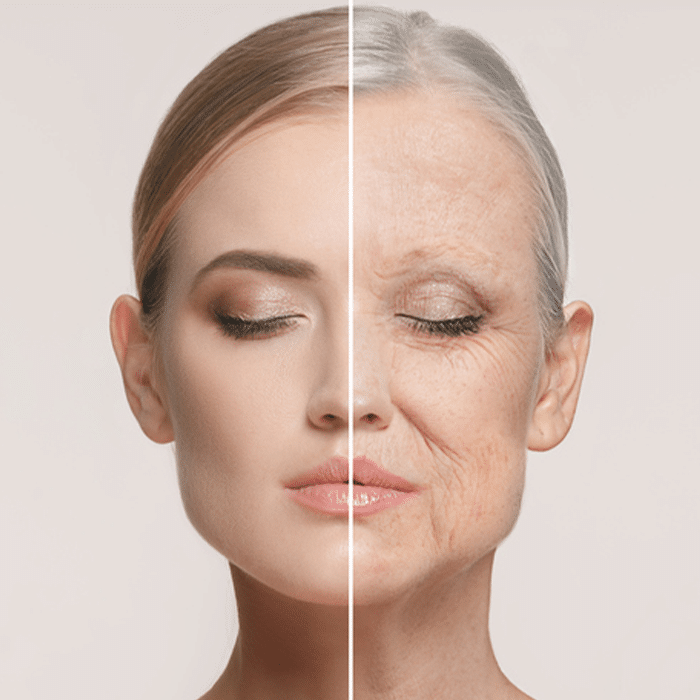 Aging Skin | White Rock Dermatology | Fine Line Control Dallas, Tx.