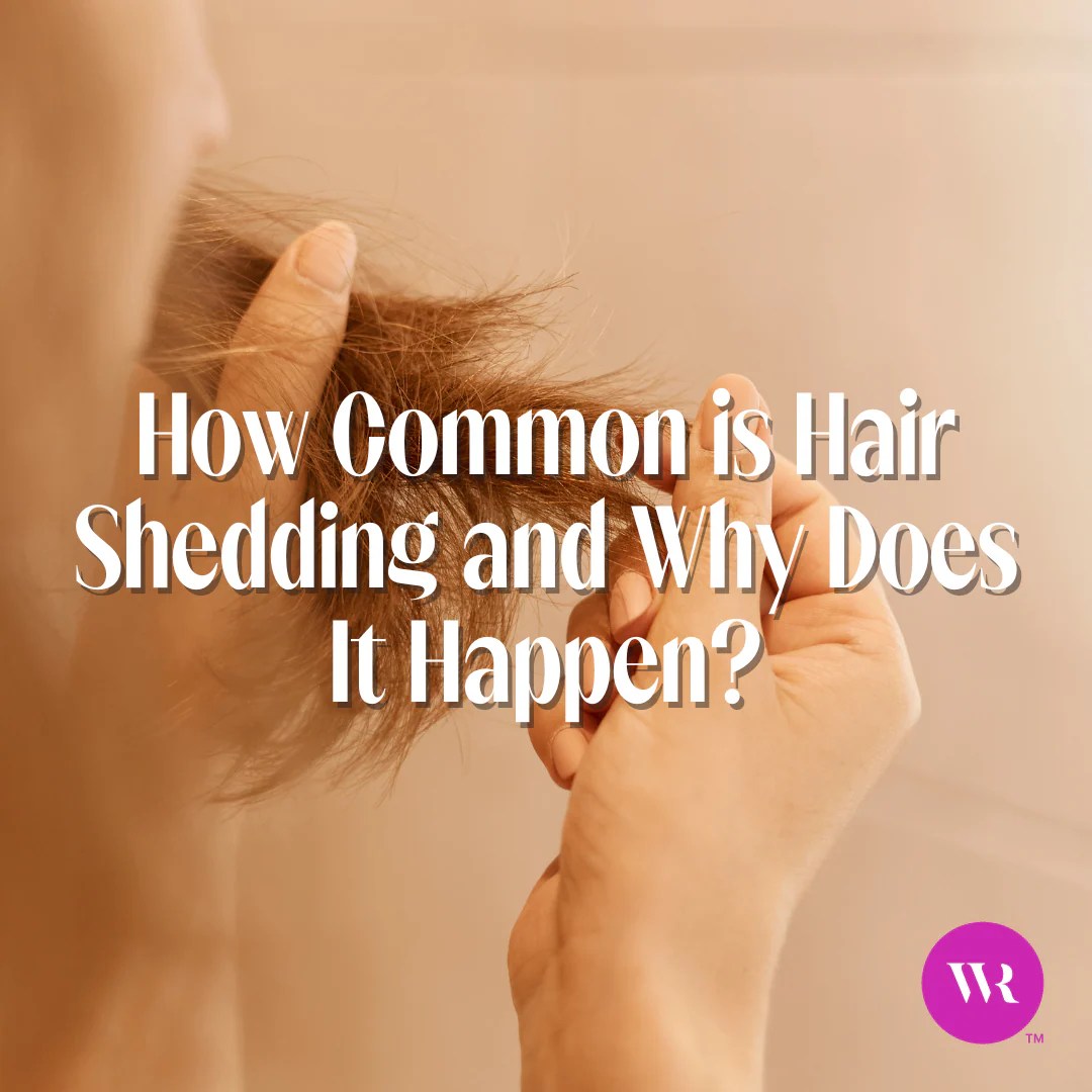 How Common Is Hair Shedding and Why Does It Happen? Wicked Roots Hair™