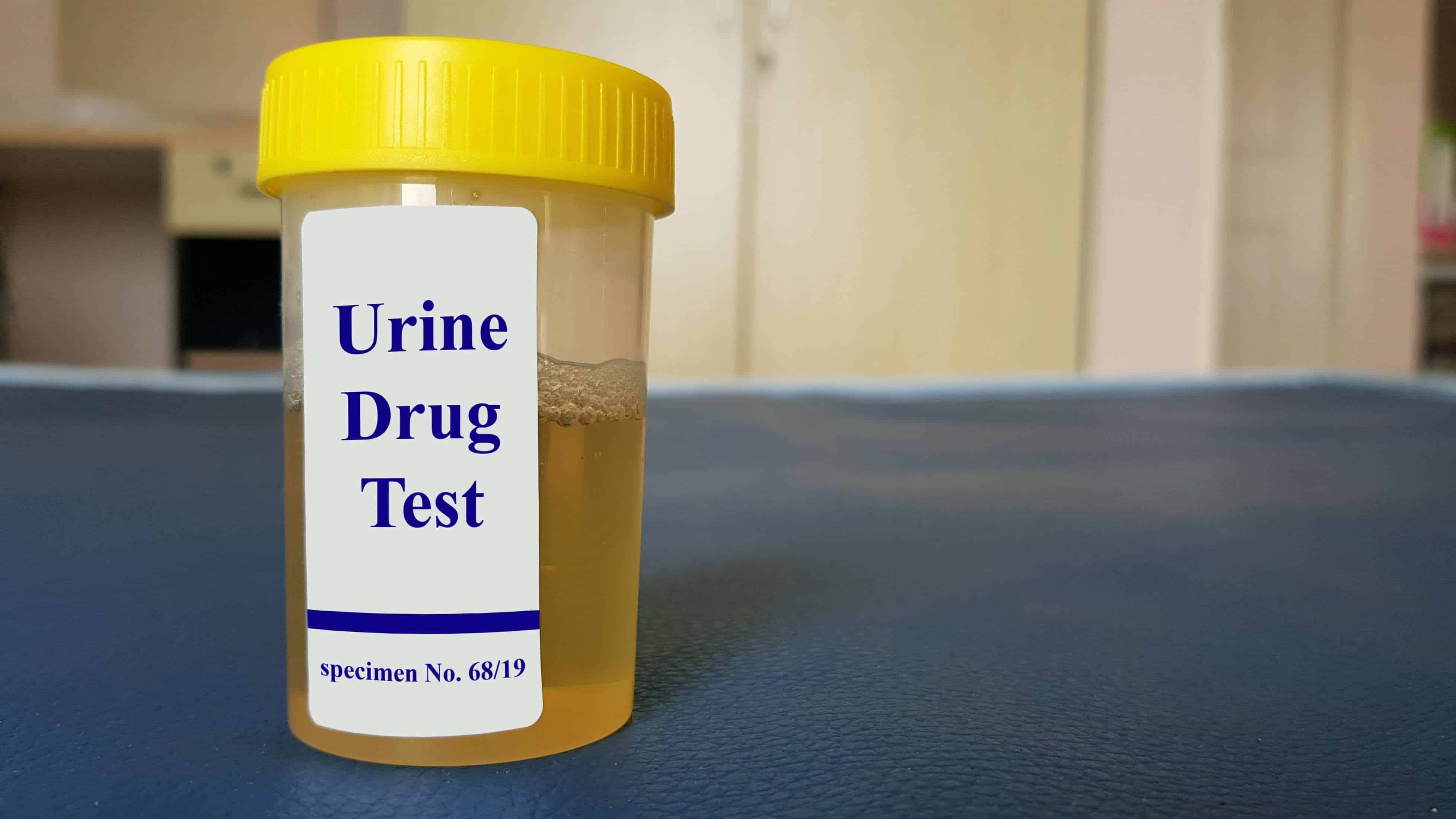 DOT drug compliance testing remains in effect during COVID era