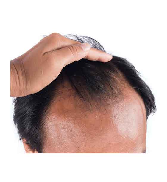 Hair Wig Shop in Karachi WigOMania UK Hair Brand