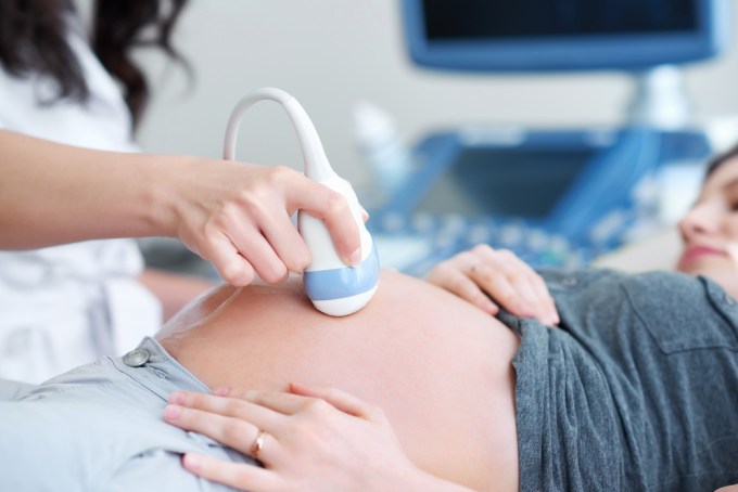 Cara Mengatasi Bayi Sungsang Saat Hamil 8 Bulan