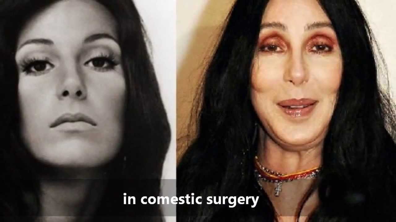 Top 9 Worst Celebrity Plastic Surgeries » Page 9 of 9 » WikiGrewal