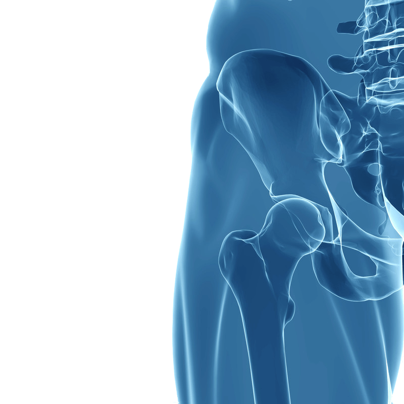 Hip Replacement Dr William Sima