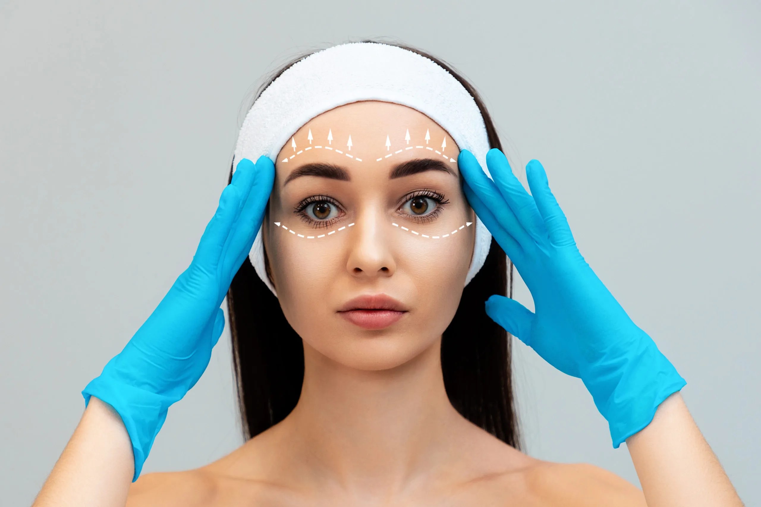 How Long Do PDO Threads Actually Last? Wilson Aesthetics