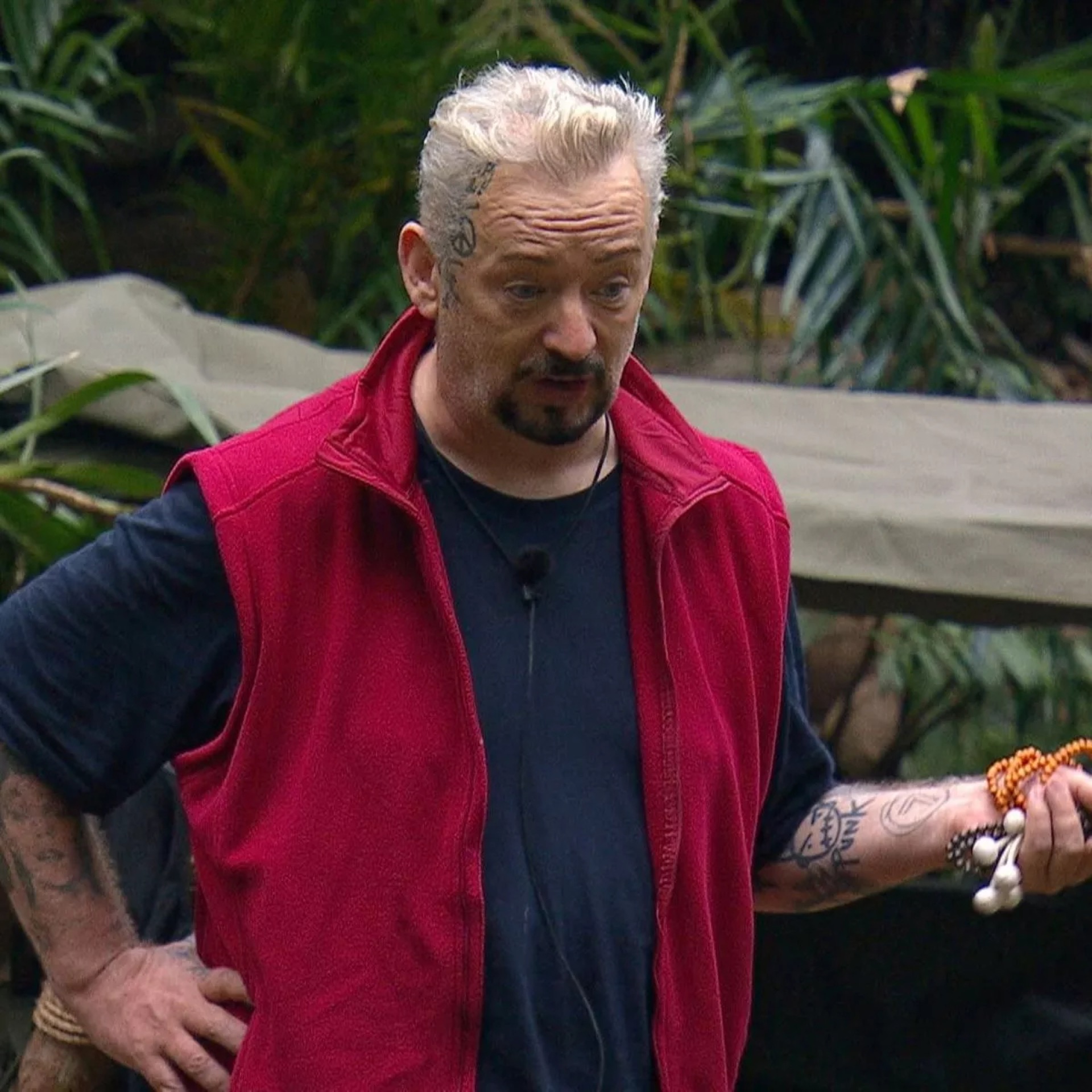 Boy Hair Transplant Everything You Need To Know