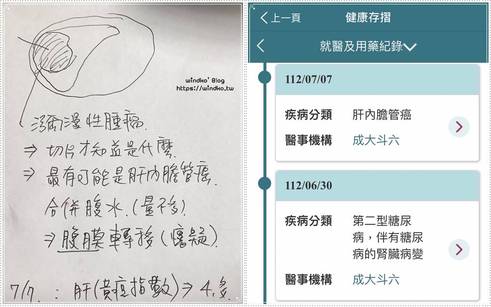 確診肝內膽管癌的歷程與安寧病房緩和醫療記錄