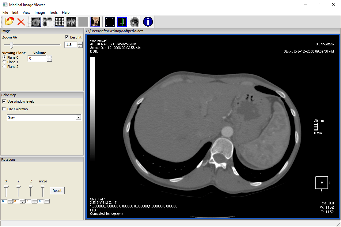Medical Image Viewer (MIView) 0.7 Build 53 Download, Review, Screenshots