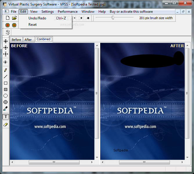 Virtual Plastic Surgery Software VPSS 1.0 Download, Review, Screenshots