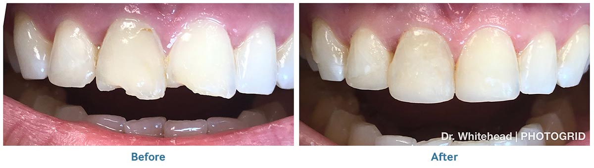 Smile Gallery Winter Park, Florida Winter Park Dentistry