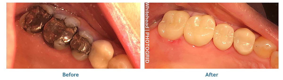 Smile Gallery Winter Park, Florida Winter Park Dentistry