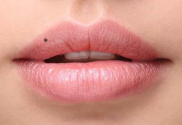 The Ultimate Guide To The Meaning Of Moles On Your Face (Accurate) - Wisdom Tavern