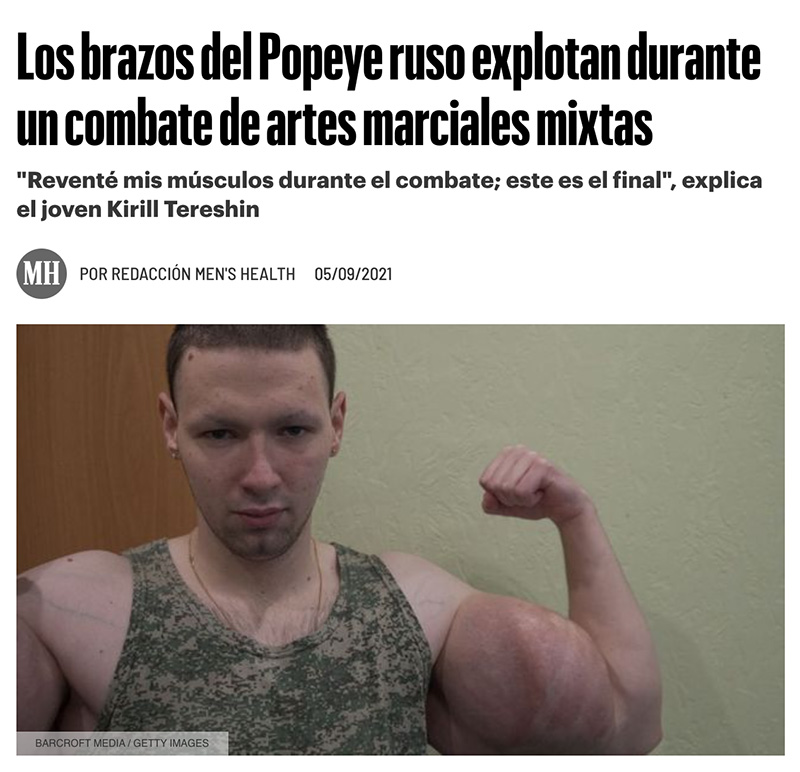 Aunque el &#x27;popeye ruso&#x27; haya conseguido sobrevivir, sigue arrastrando graves problemas de salud. Vqunnzwjv015 M