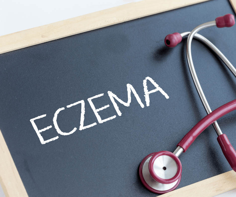 Should a child who has eczema see a dermatologist? Western Maryland