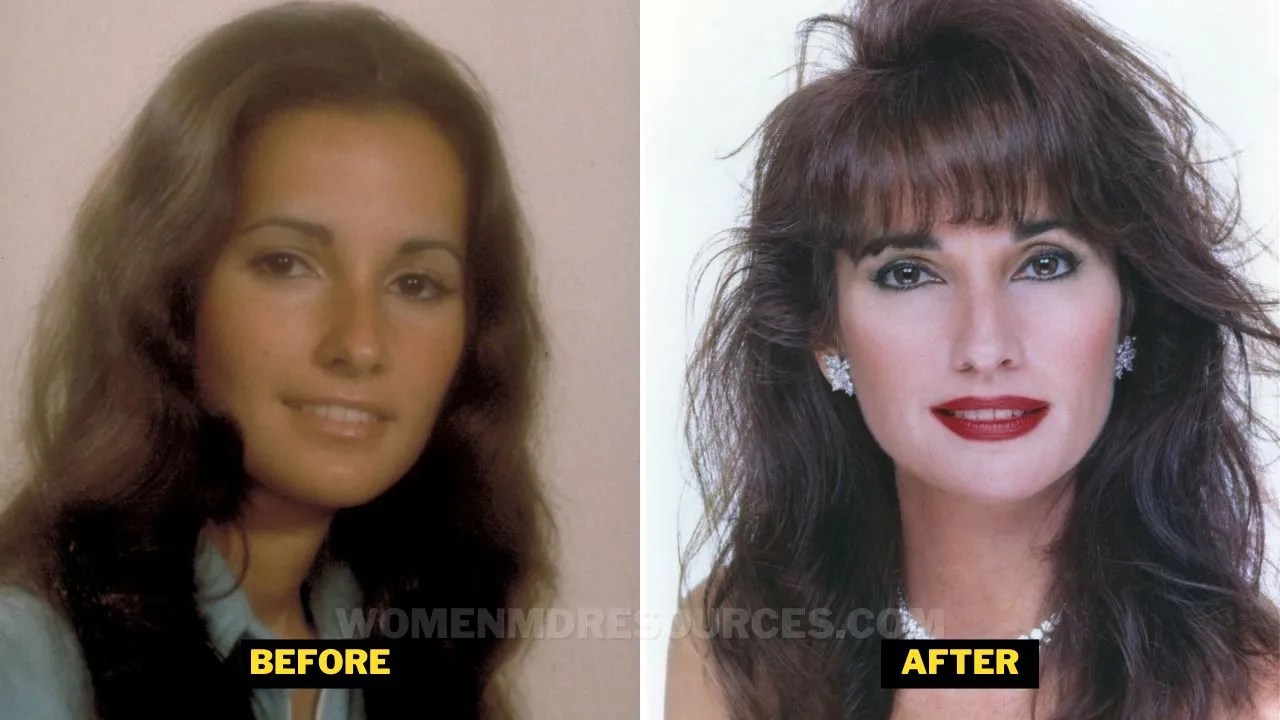 Susan Lucci Plastic Surgery And Details About Heart Attack.