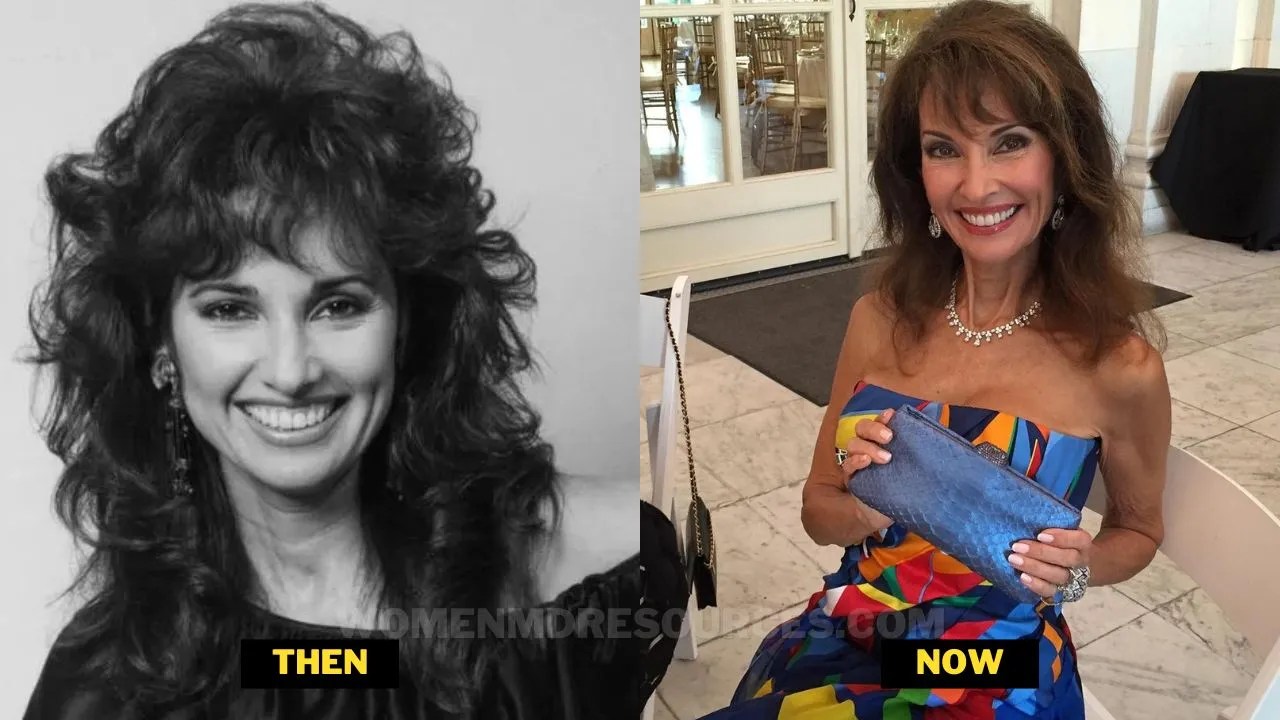 Susan Lucci Plastic Surgery And Details About Heart Attack.