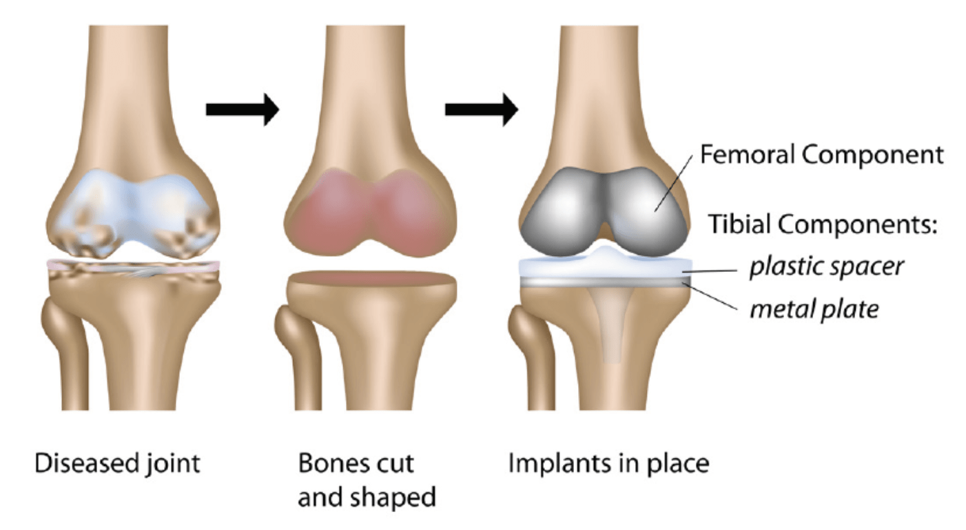 What is Orthopedics? Types of Procedures, and the Best Hospitals for