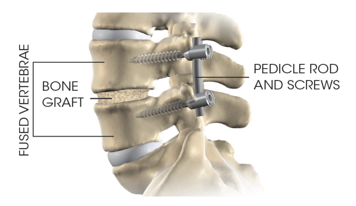 What is Orthopedics? Types of Procedures, and the Best Hospitals for