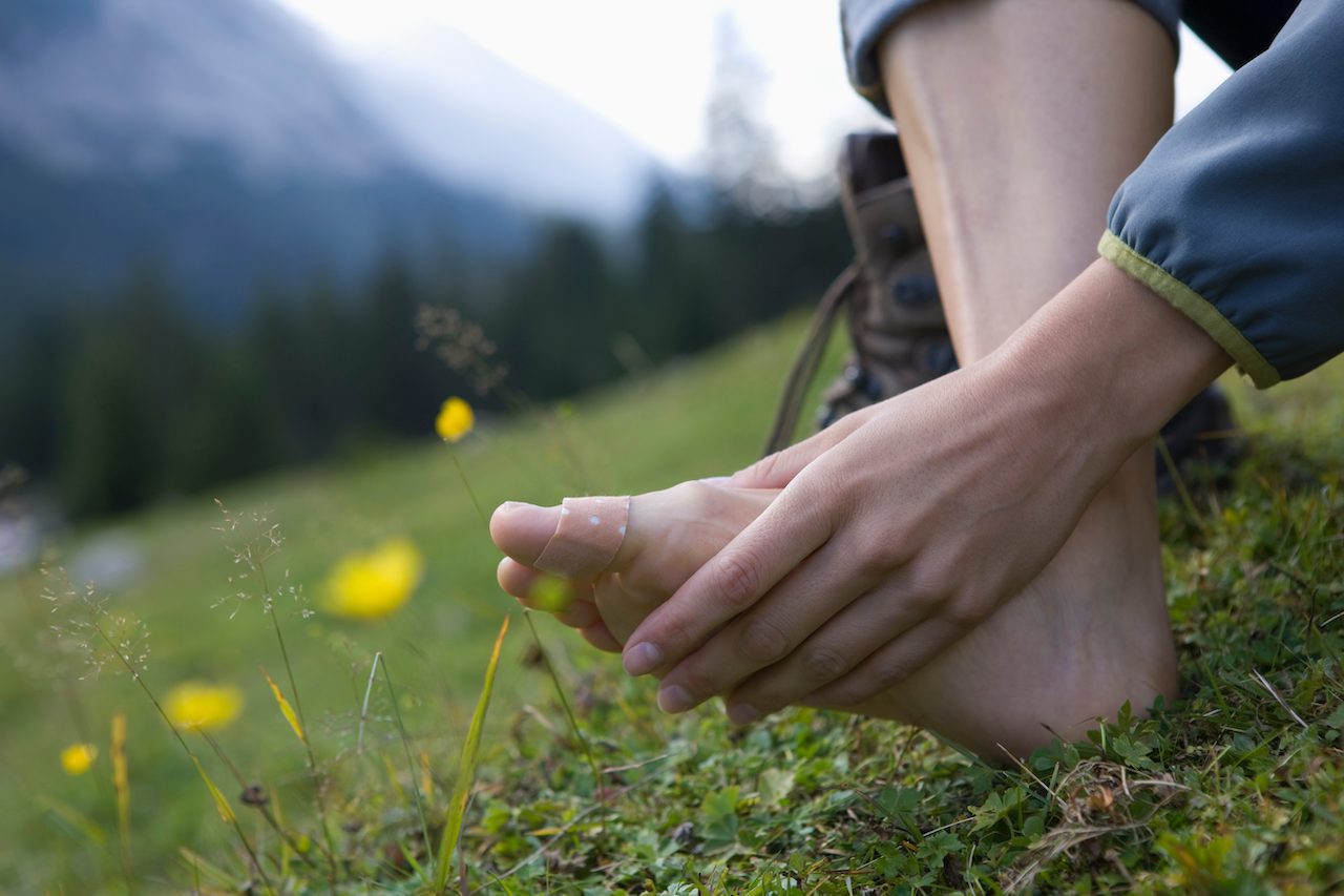 Why Do I Lose Toenails When Hiking? How To Prevent Losing Toenails When
