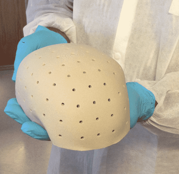 Changing Your Face Is Now Possible As FDA Approves 3D Printed Face Implants