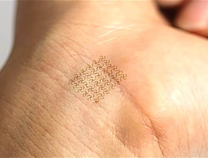 This Smart Bandage Has Embedded Electronics That Can Be