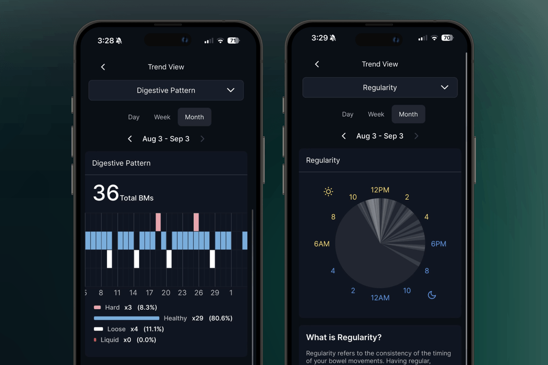 This New Toilet Camera Takes Pictures Of Your Poop To Keep Y