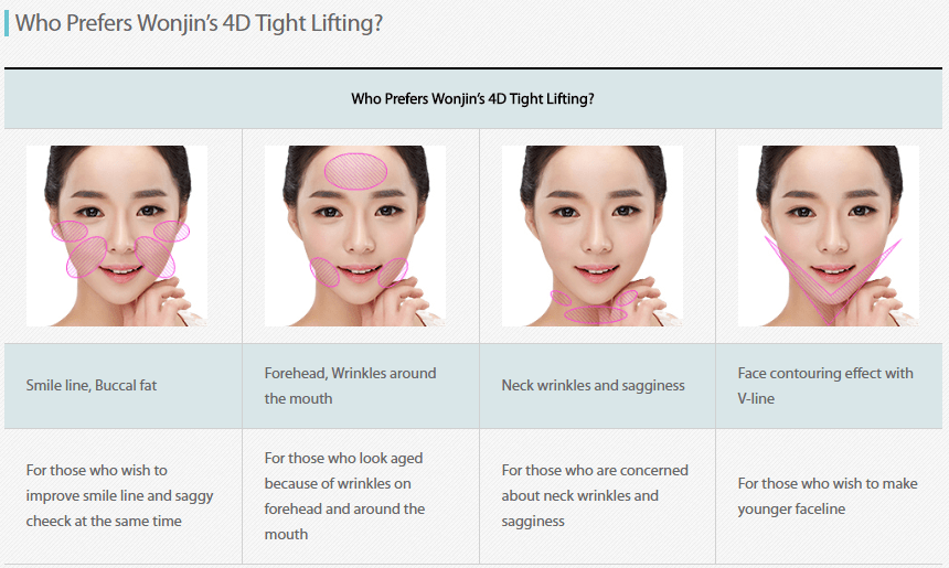 4D Lifting Exclusive on Plastic Surgery Gangnam Korea Wonjin Plastic