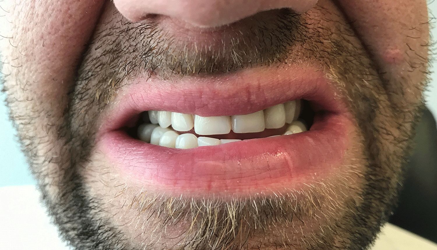 Denture Gallery Woodside Denture Centre