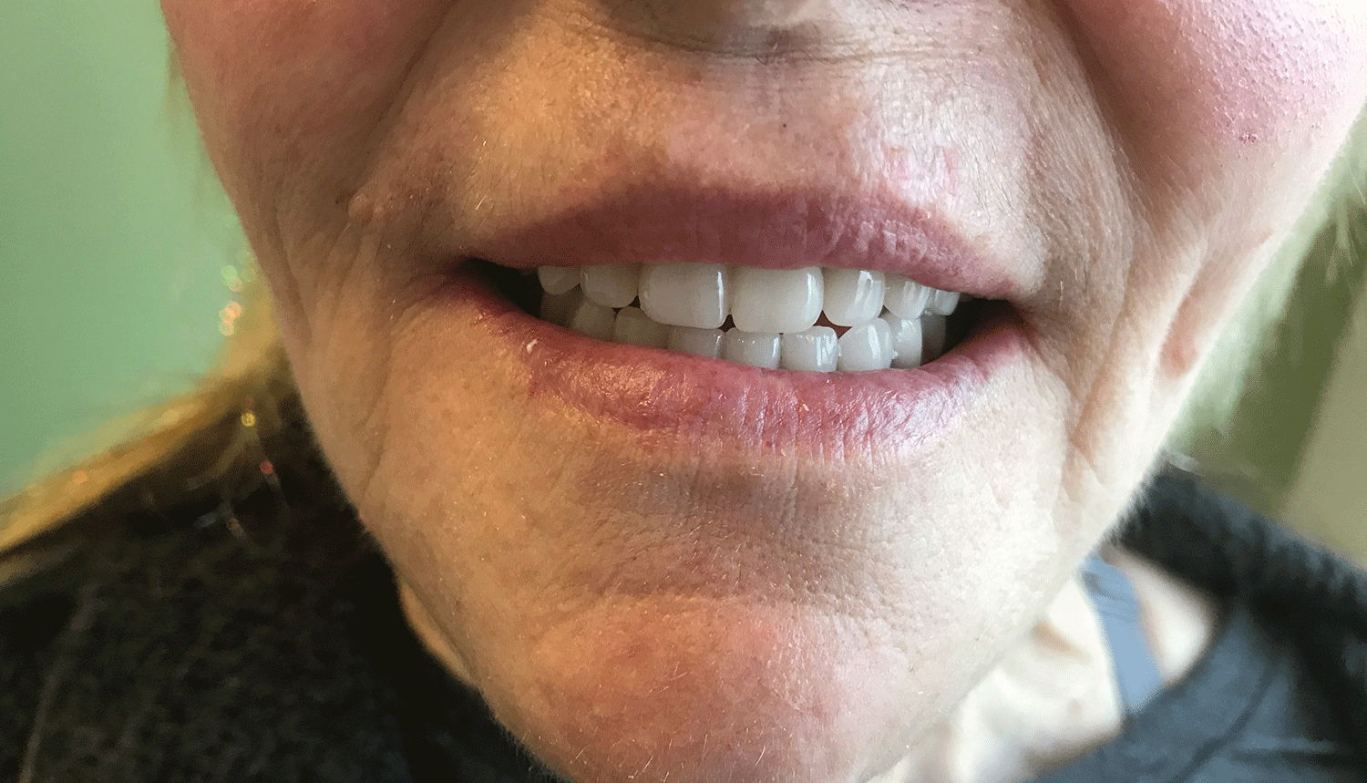 Denture Gallery Woodside Denture Centre