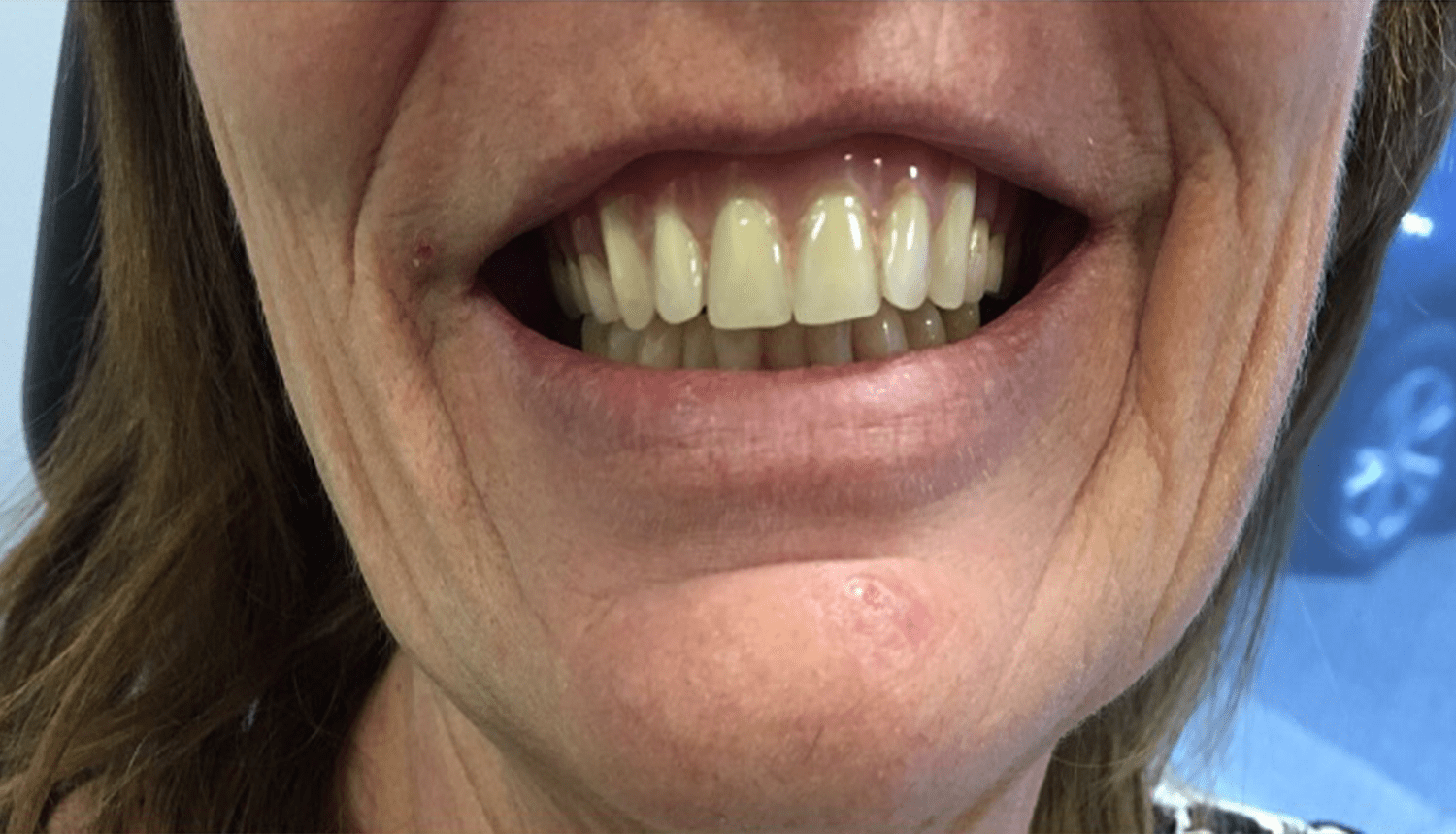 Denture Gallery Woodside Denture Centre