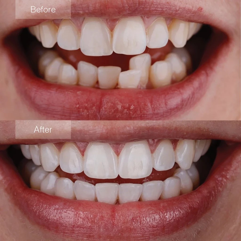 TopRated Invisalign Dentist Worcester Cosmetic & Restorative Dentistry