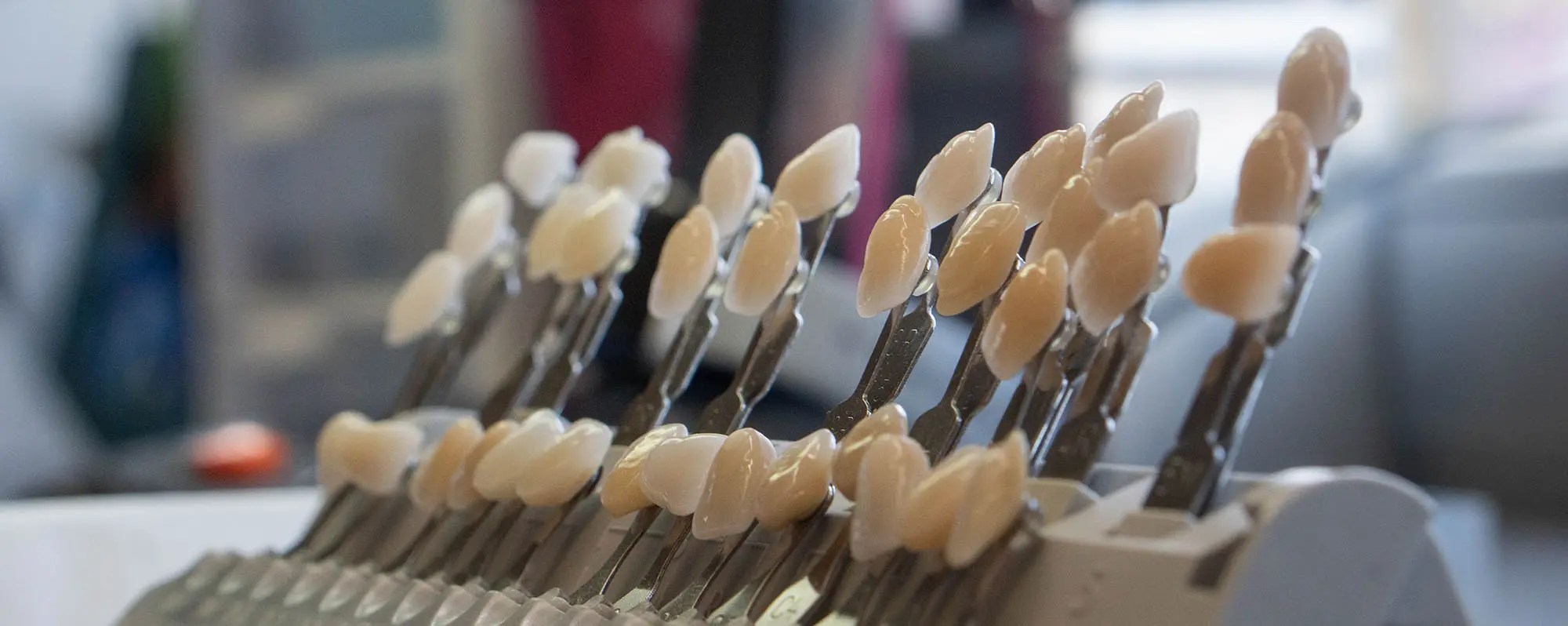 Custom Shading Creates Naturallooking Restorations Fusion Dental Lab