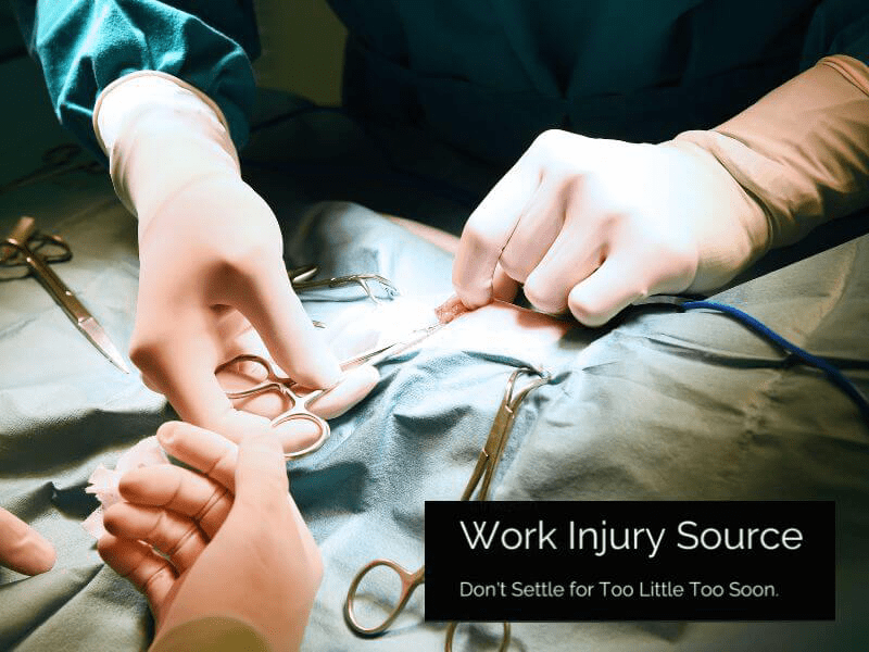 Does Surgery Increase a Workers’ Comp Settlement?