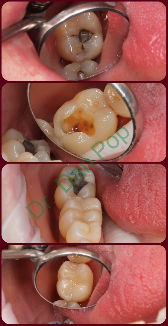 Dr. Dan V. Pop, DMD GDC registration number 254580