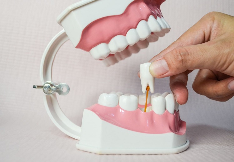 Tooth Luxation 5 Definitive Types of Dislocation