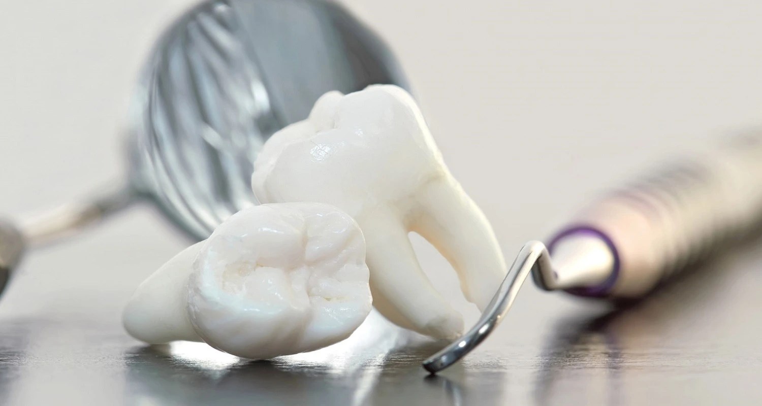 Irrigating Wisdom Tooth Socket 5 Detailed Complications