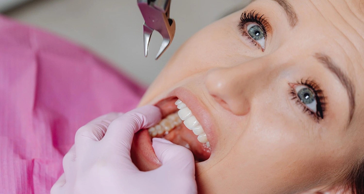 Tooth Extraction Healing Process 10 Tips For Fast Recovery