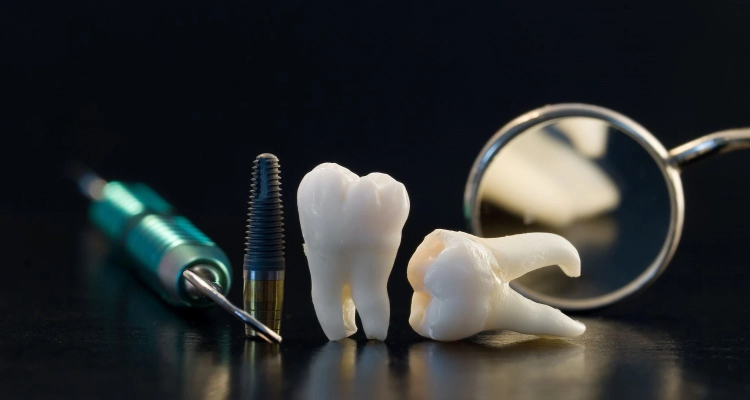 Irrigating Wisdom Tooth Socket 5 Detailed Complications