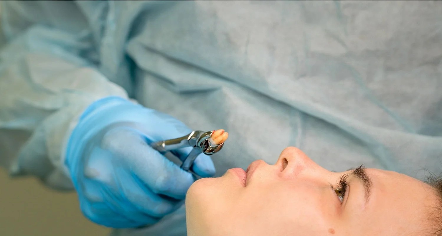 Hydrogen Peroxide on Toothache 4 Effective Relief Methods