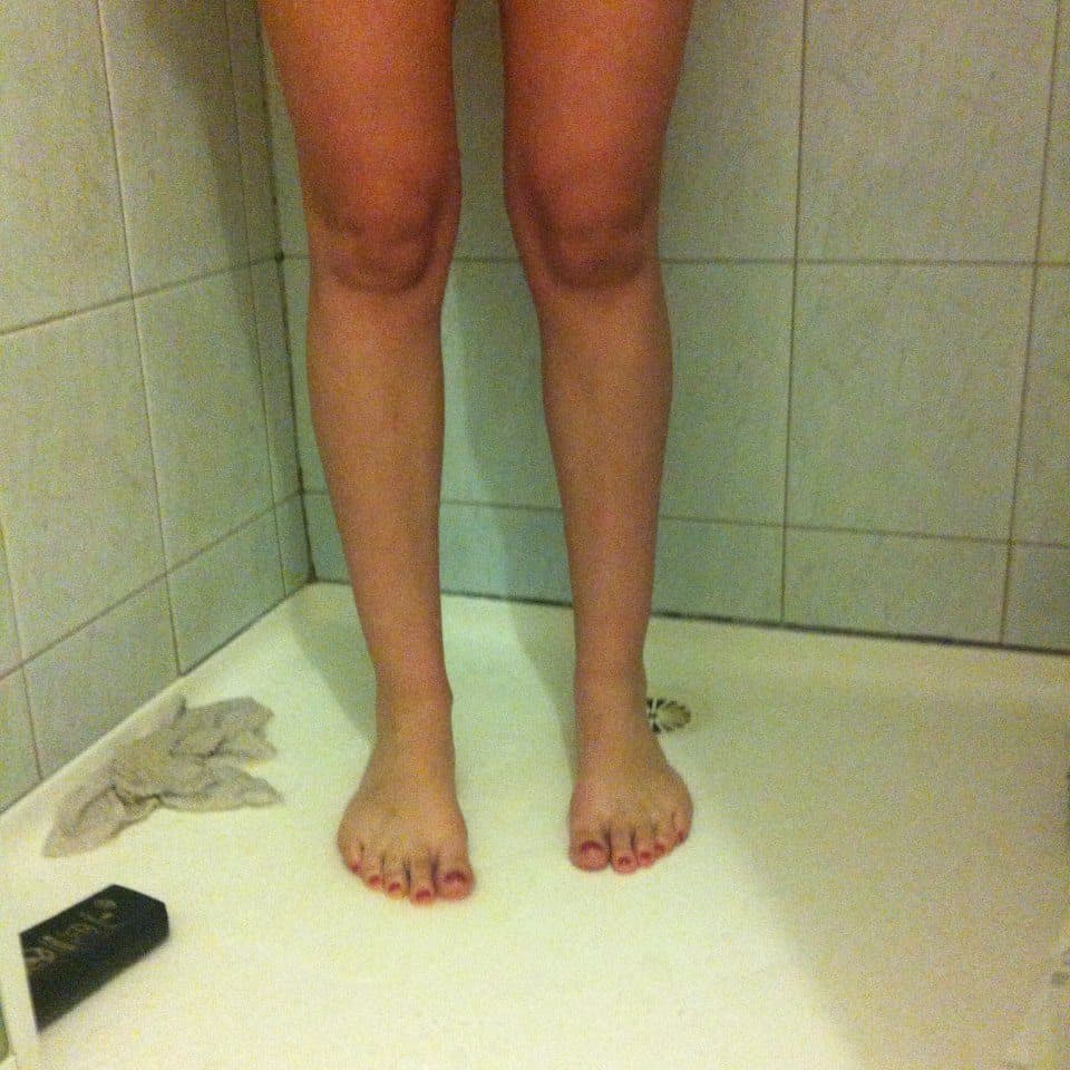 "Knee Faces" Caught in the Wild (GALLERY) WorldWideInterweb