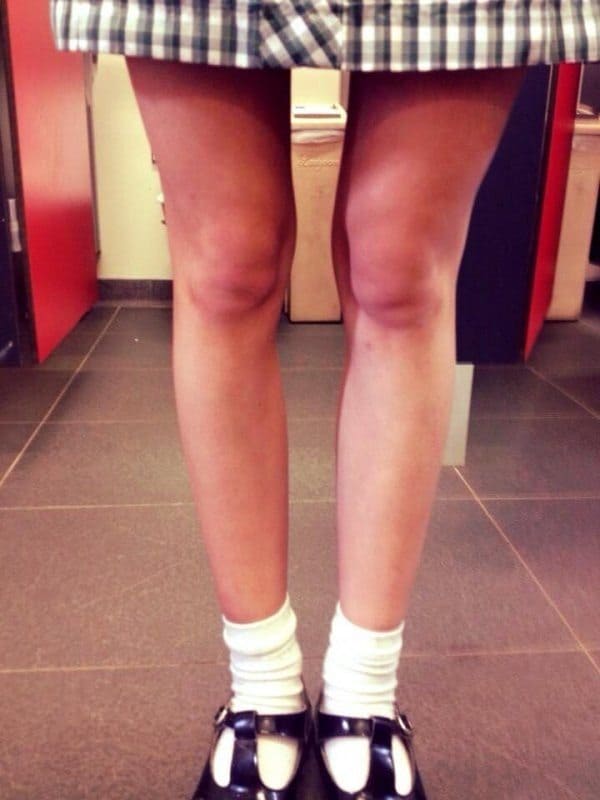 "Knee Faces" Caught in the Wild (GALLERY)