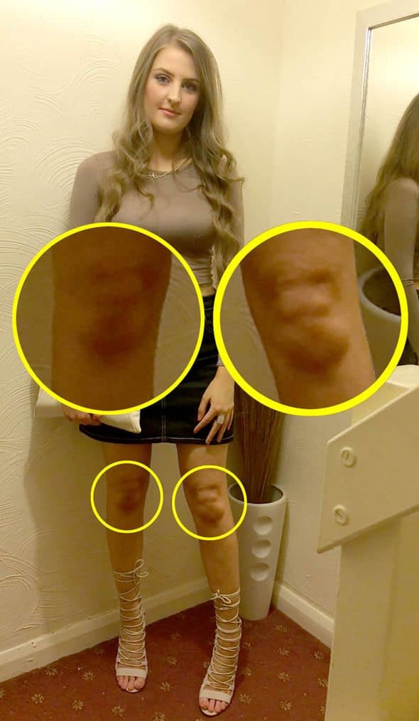 "Knee Faces" Caught in the Wild (GALLERY) WorldWideInterweb