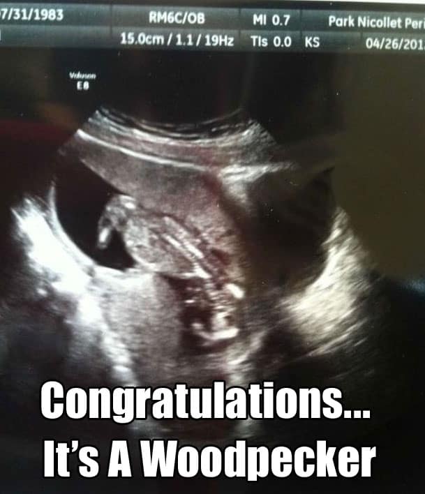 The 20 Funniest Ultrasound Pictures Ever WorldWideInterweb
