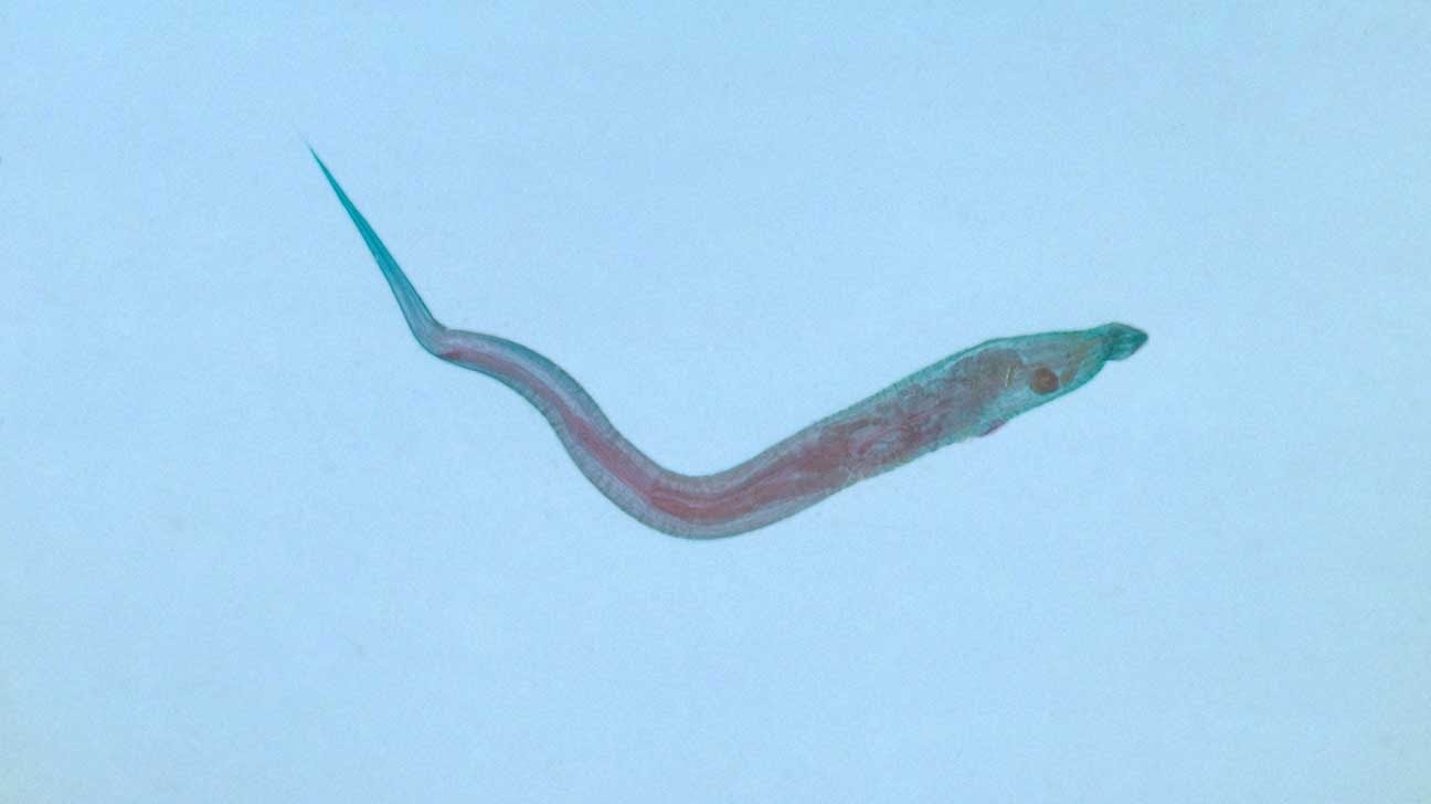 Tapeworm Vs Pinworm What Is The Difference?