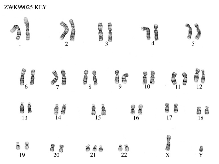 Zooweb Karyotypes 47 Xy 21