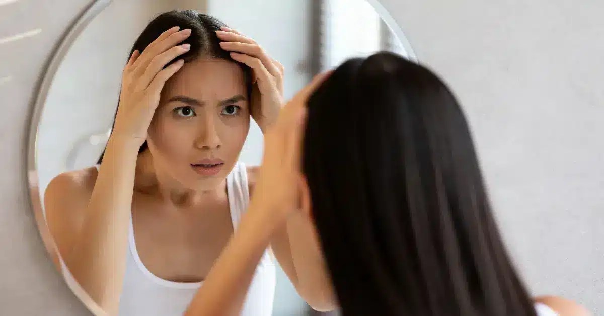 Hair Loss After Stopping Birth Control Does it Happen?