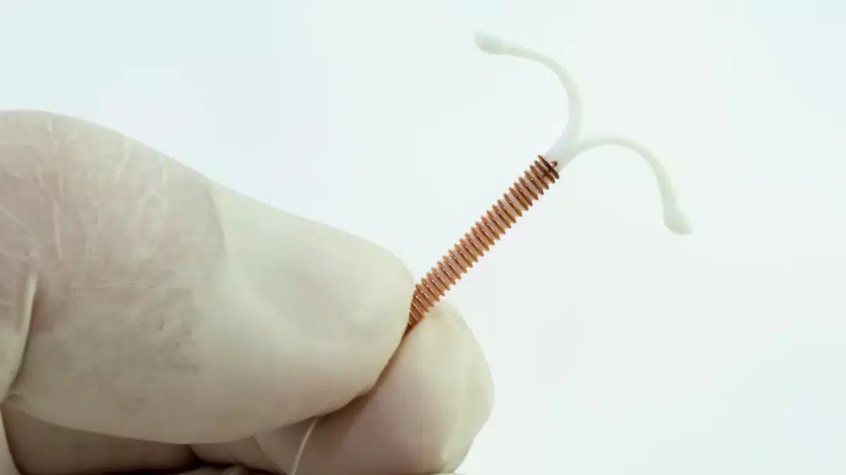 Copper IUD vs Mirena Comparison