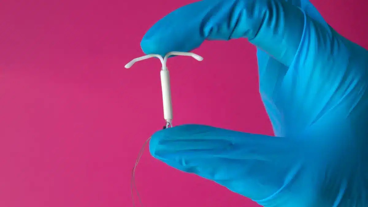 Timings, procedure, and expectations after IUD removal