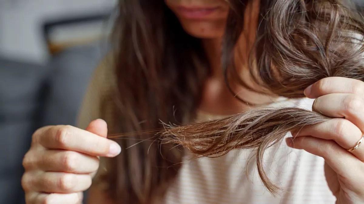 Understanding How Much Hair Loss is Normal to Lose Every Day