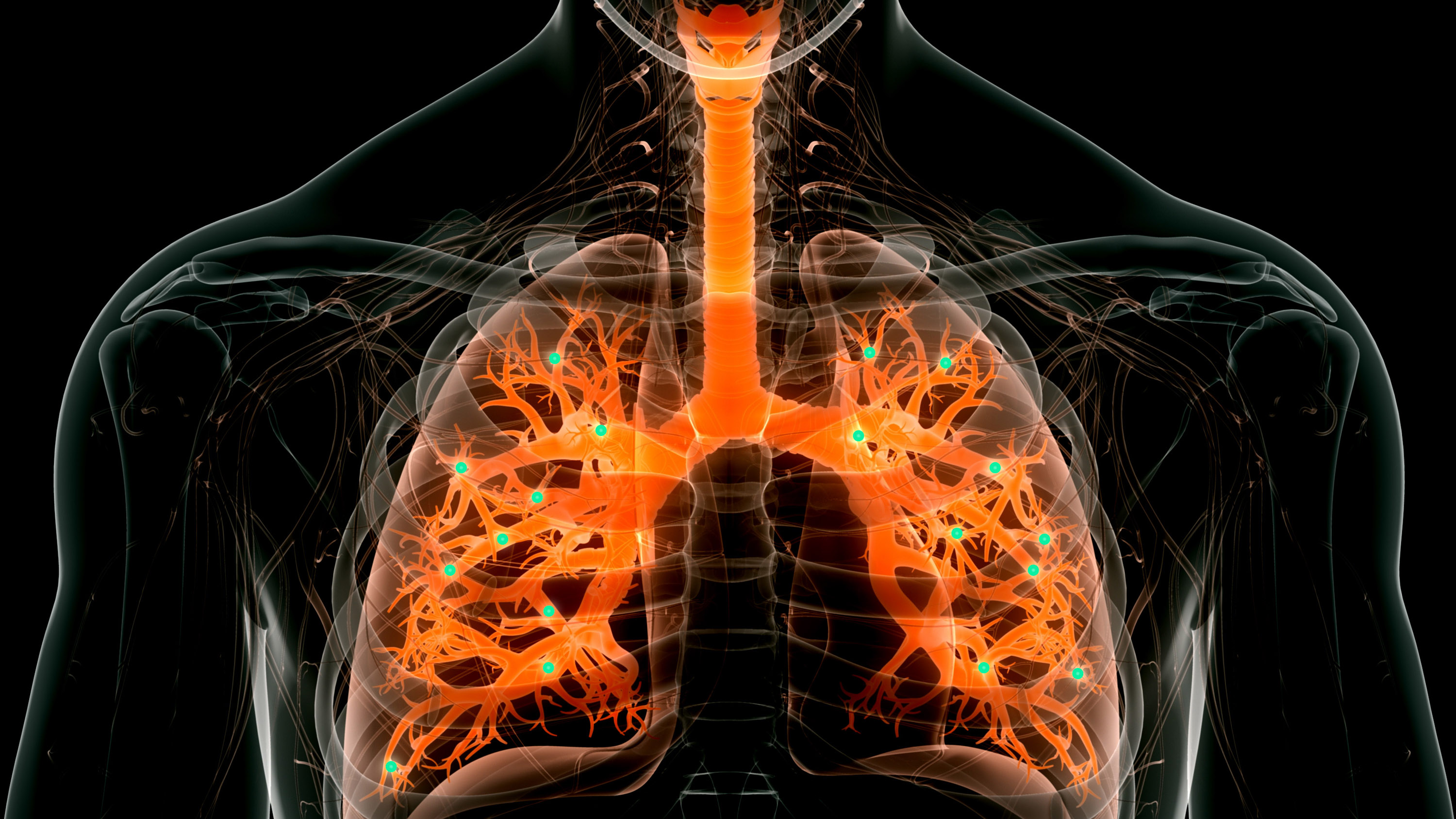 Nanoparticles target lung disease MIT Technology Review