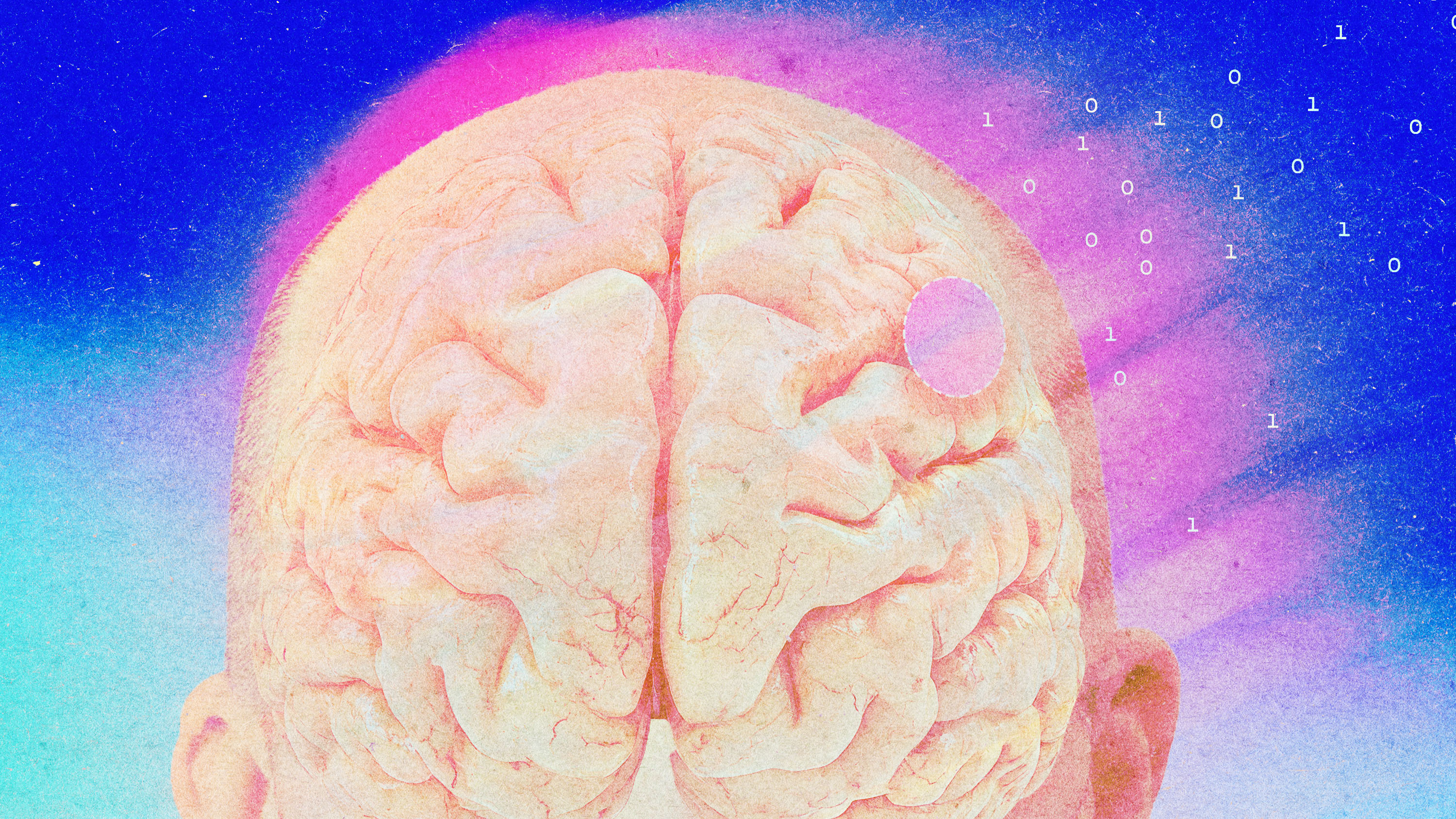 Brain-computer interface trials are taking off